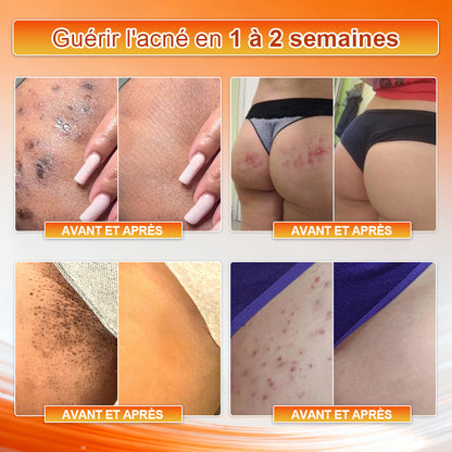 👙 Boutique officielle de la marque | Von𝑢𝑡𝑟𝑖® 2026 Shorts 4‑en‑1 à micro‑particules sculptants et brûle‑graisses à la Moringa et à la Berbérine