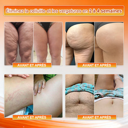 👙 Boutique officielle de la marque | Von𝑢𝑡𝑟𝑖® 2026 Shorts 4‑en‑1 à micro‑particules sculptants et brûle‑graisses à la Moringa et à la Berbérine